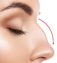 Liquid Rhinoplasty